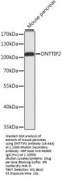 DNTTIP2 Antibody