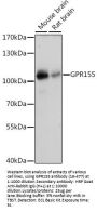 GPR155 Antibody