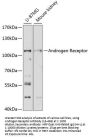 Androgen Receptor Antibody