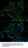 FABP2 Antibody