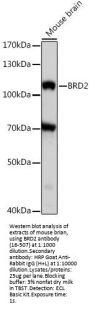 BRD2 Antibody