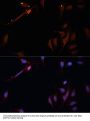 LPL Antibody