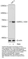 SMPD1 / ASM Antibody