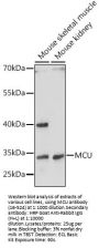 MCU Antibody