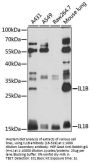 IL1B Antibody