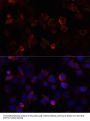 S100A4 Antibody, KO Validated