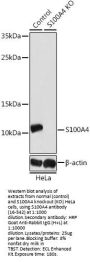 S100A4 Antibody, KO Validated