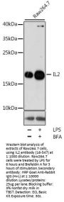 IL2 Antibody