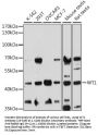 WT1 Antibody