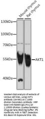 AKT1 Antibody, KO Validated