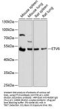 ETV6 Antibody