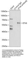 ETV6 Antibody