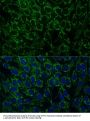 MTIF2 Antibody