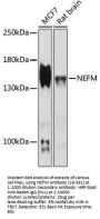 NEFM Antibody
