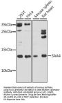 SAA4 Antibody