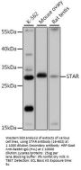 STAR Antibody