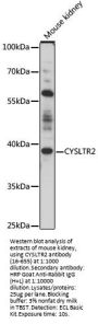CYSLTR2 Antibody