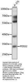 PDSS2 Antibody