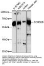 CORO2B Antibody