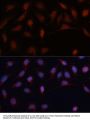 ASC / TMS1 Antibody