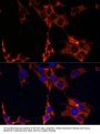ERK1 / ERK2 Antibody