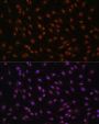 p27 KIP 1 Antibody