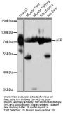 AFP Antibody