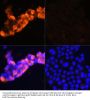 AFP Antibody