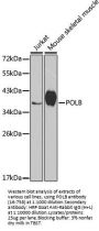 POLB Antibody, KO Validated