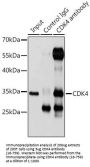 CDK4 Antibody