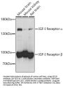 IGF1R Antibody