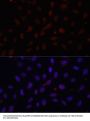 COL1A1 Antibody