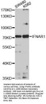 IFNAR1 Antibody