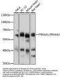 PRKAA1/PRKAA2 Antibody