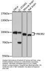 PIK3R2 Antibody