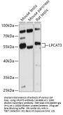 LPCAT3 Antibody