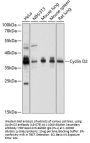 Cyclin D2 Antibody