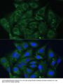 IGF2BP2 Antibody