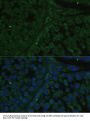 IGF2BP2 Antibody