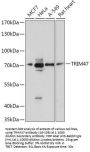 TRIM47 Antibody