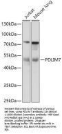 PDLIM7 Antibody