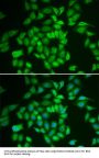 CSNK1E Antibody, KO Validated