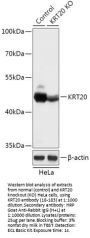 KRT20 Antibody, KO Validated