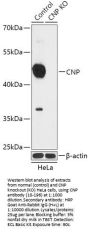 CNP Antibody, KO Validated