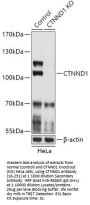 CTNND1 Antibody, KO Validated