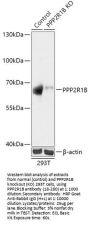 PPP2R1B Antibody, KO Validated