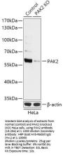 PAK2 Antibody, KO Validated