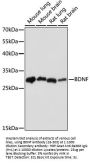 BDNF Antibody [10B3D3]