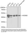 HSD3B2 Antibody