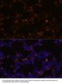 SFTPC Antibody
